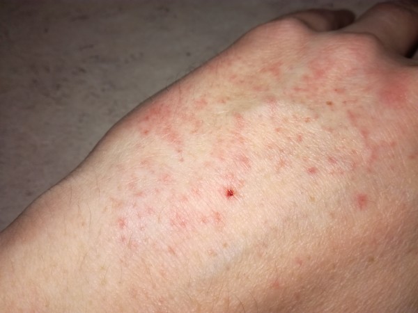 IMG_20171210_153019.jpg (3.15 MiB) Zobrazeno 1020 x IMG_20171210_153019.jpg